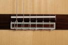 Cordoba F7 Flamenco Konzertgitarre